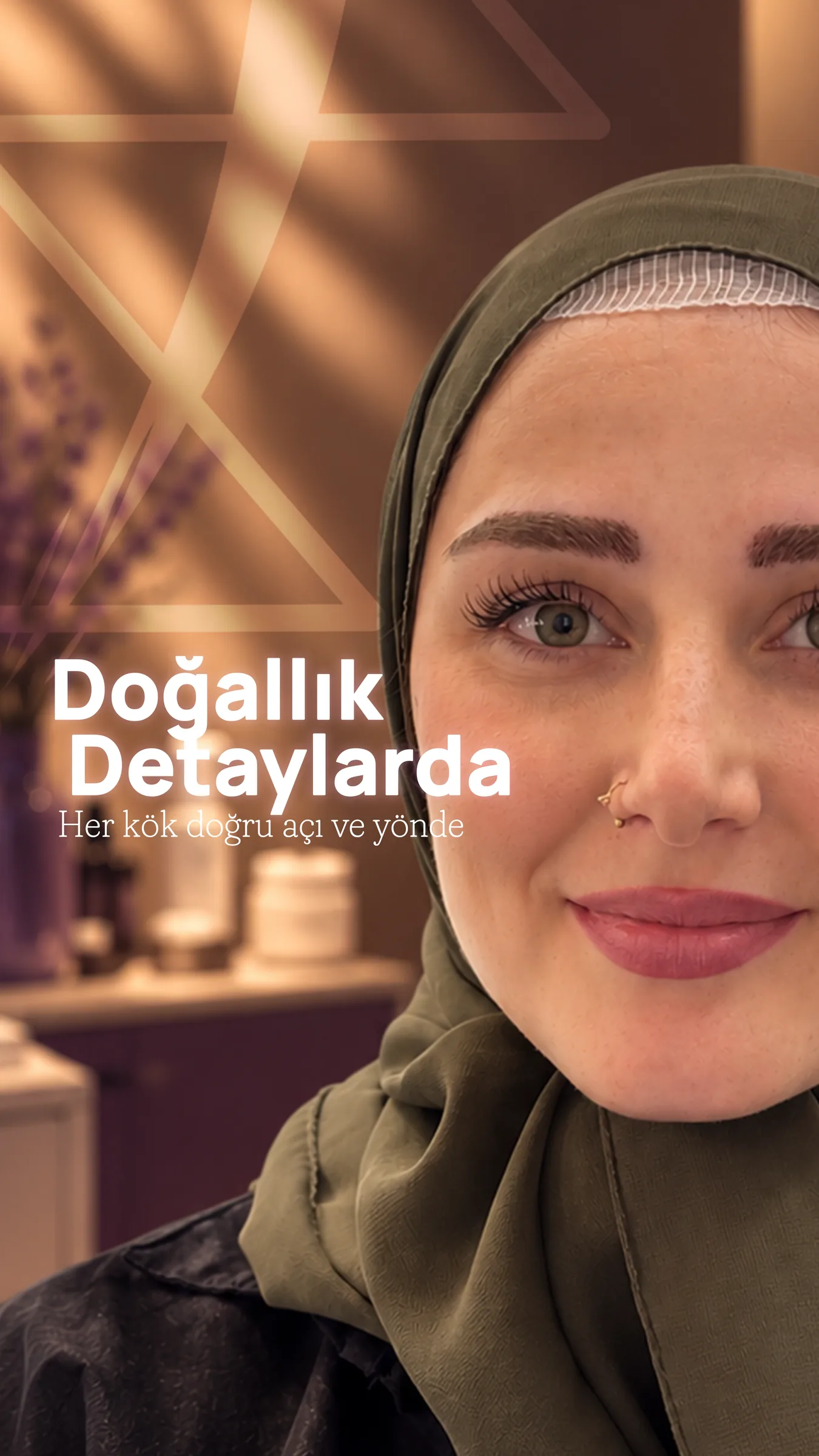 Klinik odasında gülümseyen bir hasta; üzerinde “Doğallık Detaylarda — her kök doğru açı ve yönde” yazıyor.